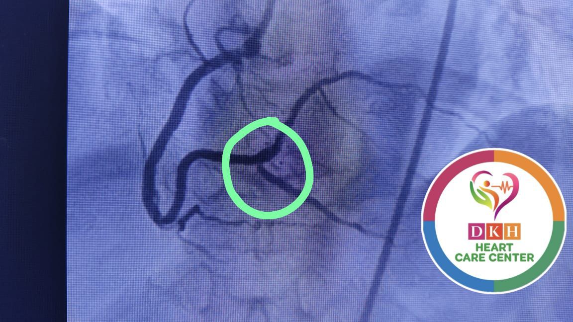 Medical Angiogram Image 3